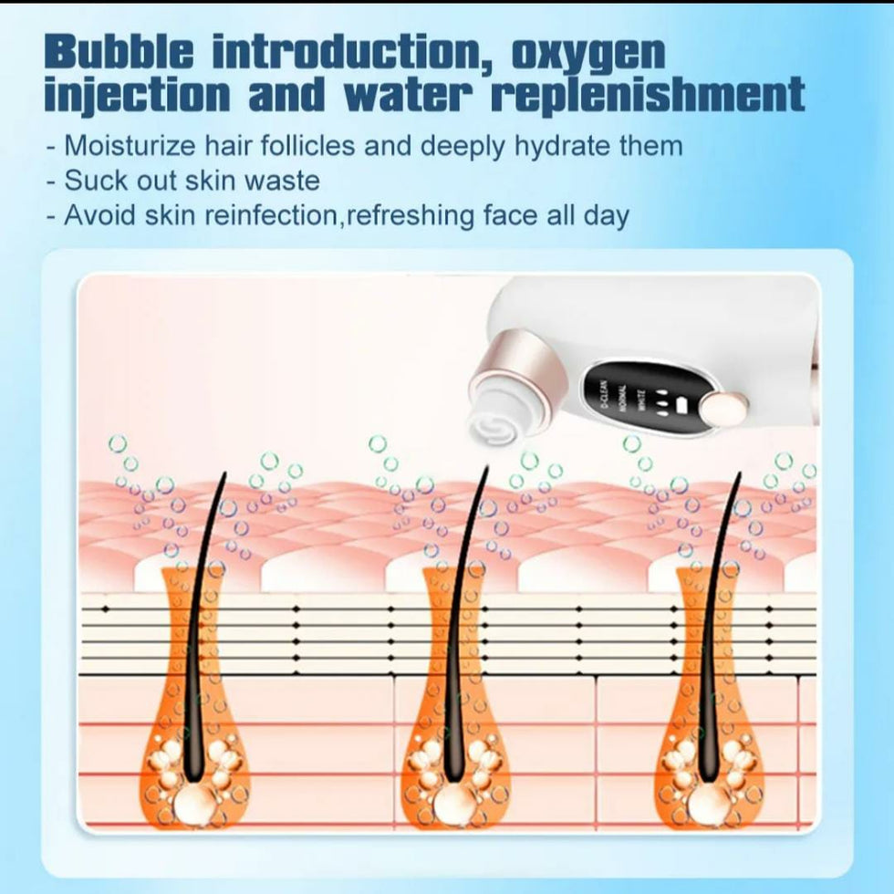 Dermaclear Super Micro Bubble Facial Vacuum & Blackhead Remover