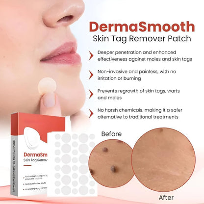 ✨ DermaSmooth™ Skin Tag Removal Patches | Safe, Painless & Fast-Acting Formula