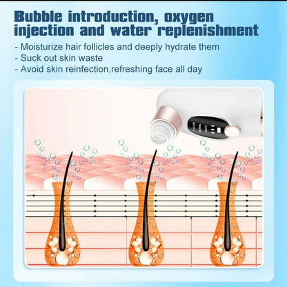 Dermaclear Super Micro Bubble Facial Vacuum & Blackhead Remover